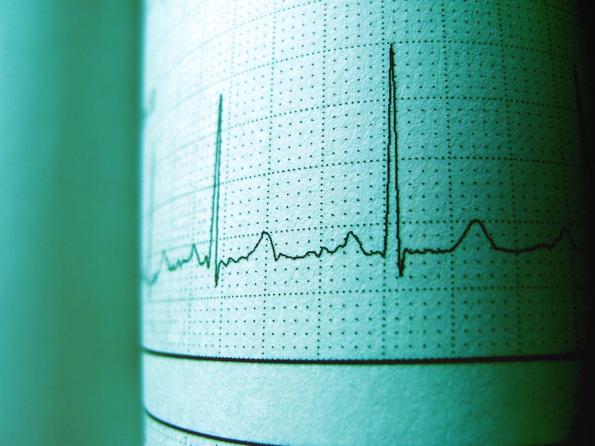 Printed electrocardiogram trace